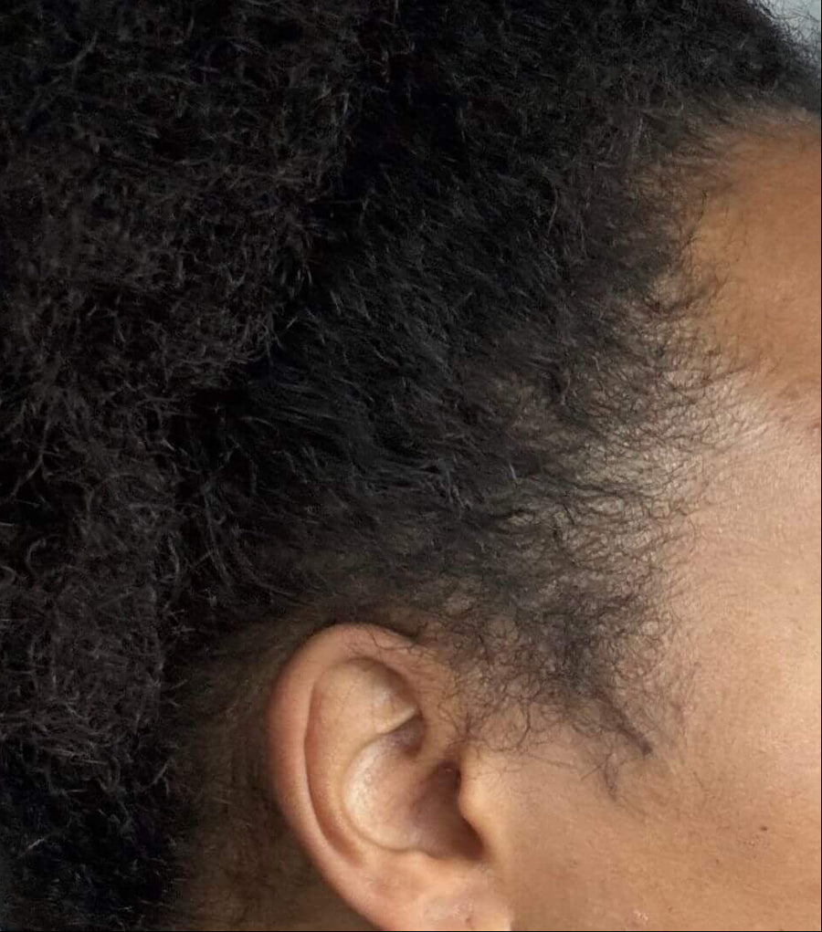 After using Froday leave-in and oil showing smoother, fuller-looking edges